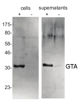 western blot detection using anti-GTA antibodies